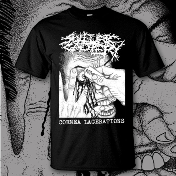 SULFURIC CAUTERY - Cornea Lacerations - T-Shirt Größe L