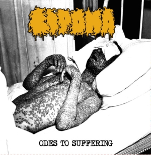 LIPOMA - 12'' LP - Odes To Suffering (White Vinyl)