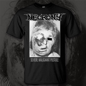 NECRONY - Severe Malignant Pustule - T-Shirt